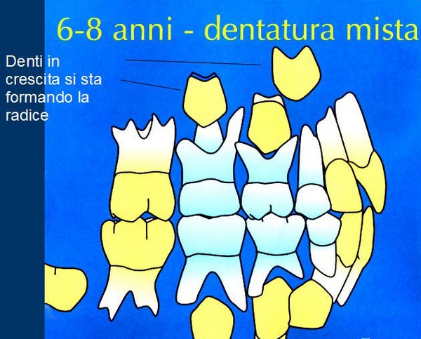 brogi la crescita dei denti dentatura mista