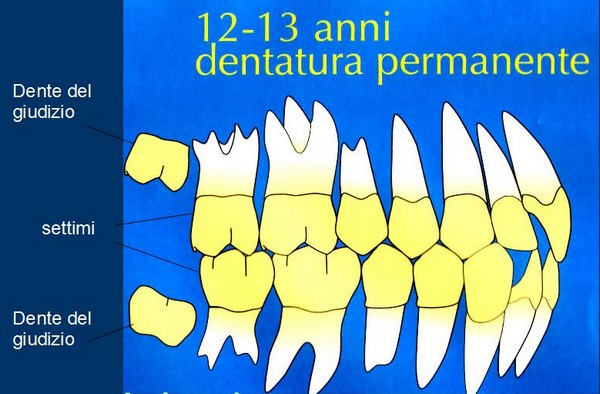 brogi la crescita dei denti dentatura permanente