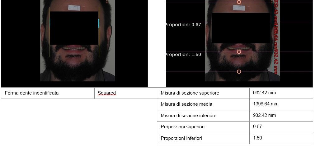 brogi progettazione sorriso analisi facciale
