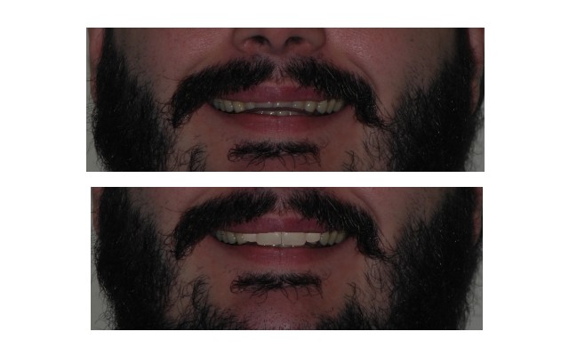 brogi progettazione sorriso anteprima